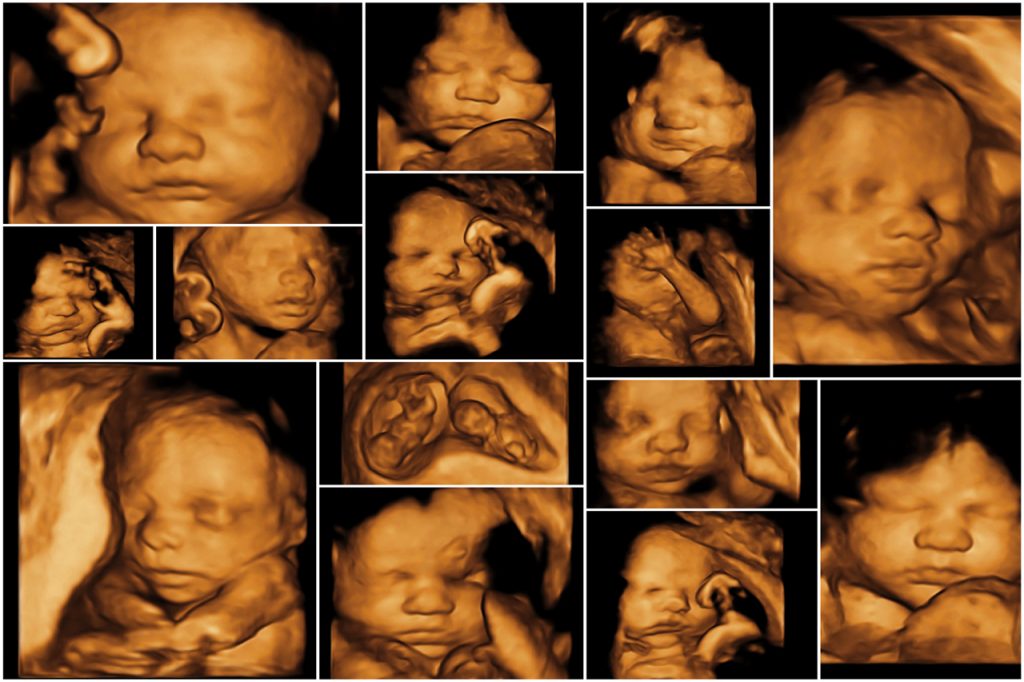 Materno Fetal Materno Fetal