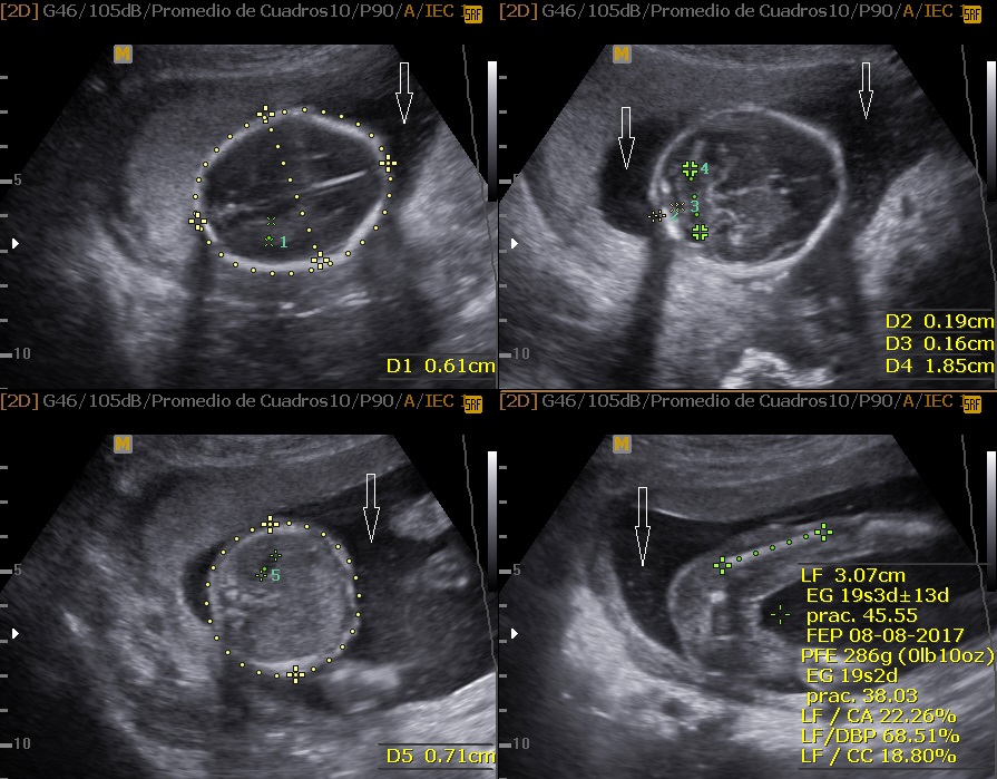 Maternofetal Maternofetal